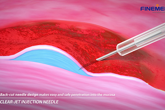FINEMEDIX Clear-Jet Injection Catheter – any3d